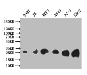 Western Blot: Thymidine Kinase 1 Antibody (6F6) [NBP3-26286] - Positive Western Blot detected in: 293T whole cell lysate, JK whole cell lysate, MCF7 whole cell lysate, A549 whole cell lysate, PC-3 whole cell lysate, K562 whole cell lysate. All lanes: Thymidine Kinase 1 Antibody at 1: 1000 Secondary: Goat polyclonal to rabbit IgG at 1/50000 dilution. Predicted band size: 26 kDa Observed band size: 26 kDa