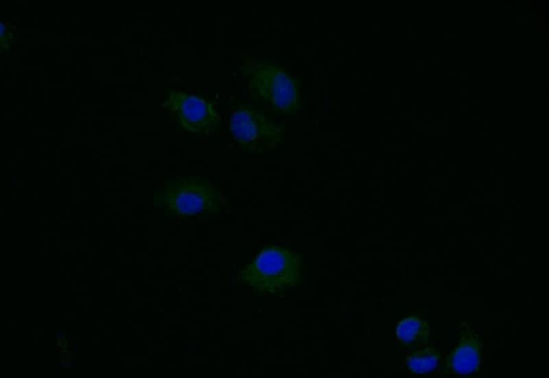 Immunocytochemistry/Immunofluorescence: Thymidine Kinase 1 Antibody (6F6) [NBP3-26286] - Staining of Hela with Thymidine Kinase 1 Antibody (6F6) at 1:40, counter-stained with DAPI. The cells were fixed in 4% formaldehyde and blocked in 10% normal Goat Serum. The cells were then incubated with the antibody overnight at 4C. The secondary antibody was Alexa Fluor 491-conjugated Goat Anti-Rabbit IgG (H+L).