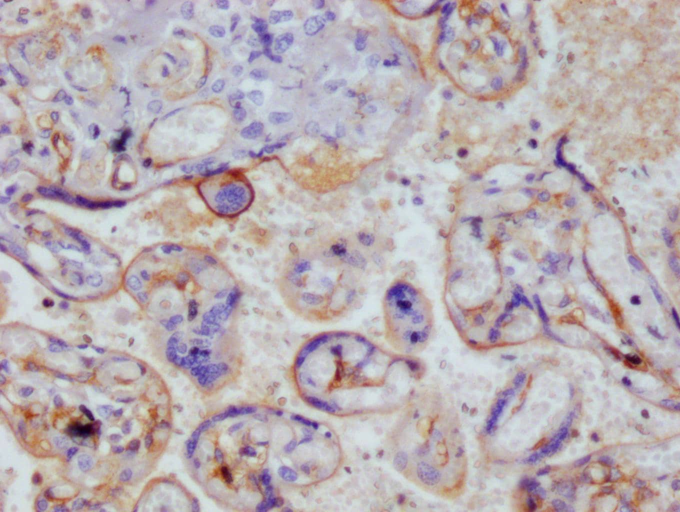 Immunohistochemistry: Thrombomodulin/BDCA-3 Antibody (15C7) [NBP3-26288] - Image of Thrombomodulin/BDCA-3 Antibody (15C7) diluted at 1:100 and staining in paraffin-embedded human placenta tissue performed. After dewaxing and hydration, antigen retrieval was mediated by high pressure in a citrate buffer (pH 6.0). Section was blocked with 10% normal goat serum 30min at RT. Then primary antibody (1% BSA) was incubated at 4°C overnight. The primary is detected by a Goat anti-rabbit polymer IgG labeled by HRP and visualized using 0.05% DAB.