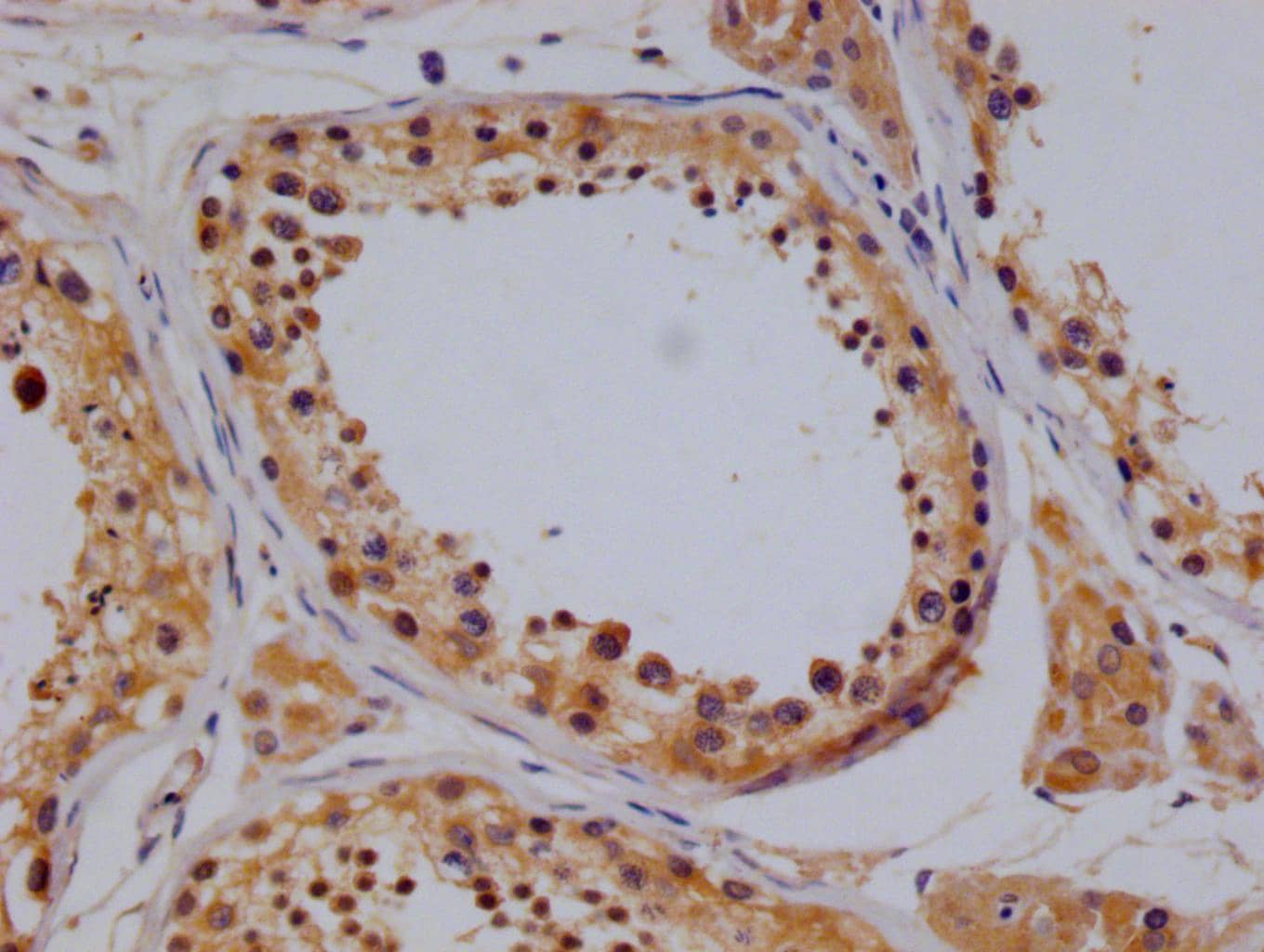 Immunohistochemistry: TBK1 Antibody (14D10) [NBP3-26292] - Image of TBK1 Antibody (14D10) diluted at 1:100 and staining in paraffin-embedded human testis tissue performed. After dewaxing and hydration, antigen retrieval was mediated by high pressure in a citrate buffer (pH 6.0). Section was blocked with 10% normal goat serum 30min at RT. Then primary antibody (1% BSA) was incubated at 4C overnight. The primary is detected by a Goat anti-rabbit polymer IgG labeled by HRP and visualized using 0.05% DAB.