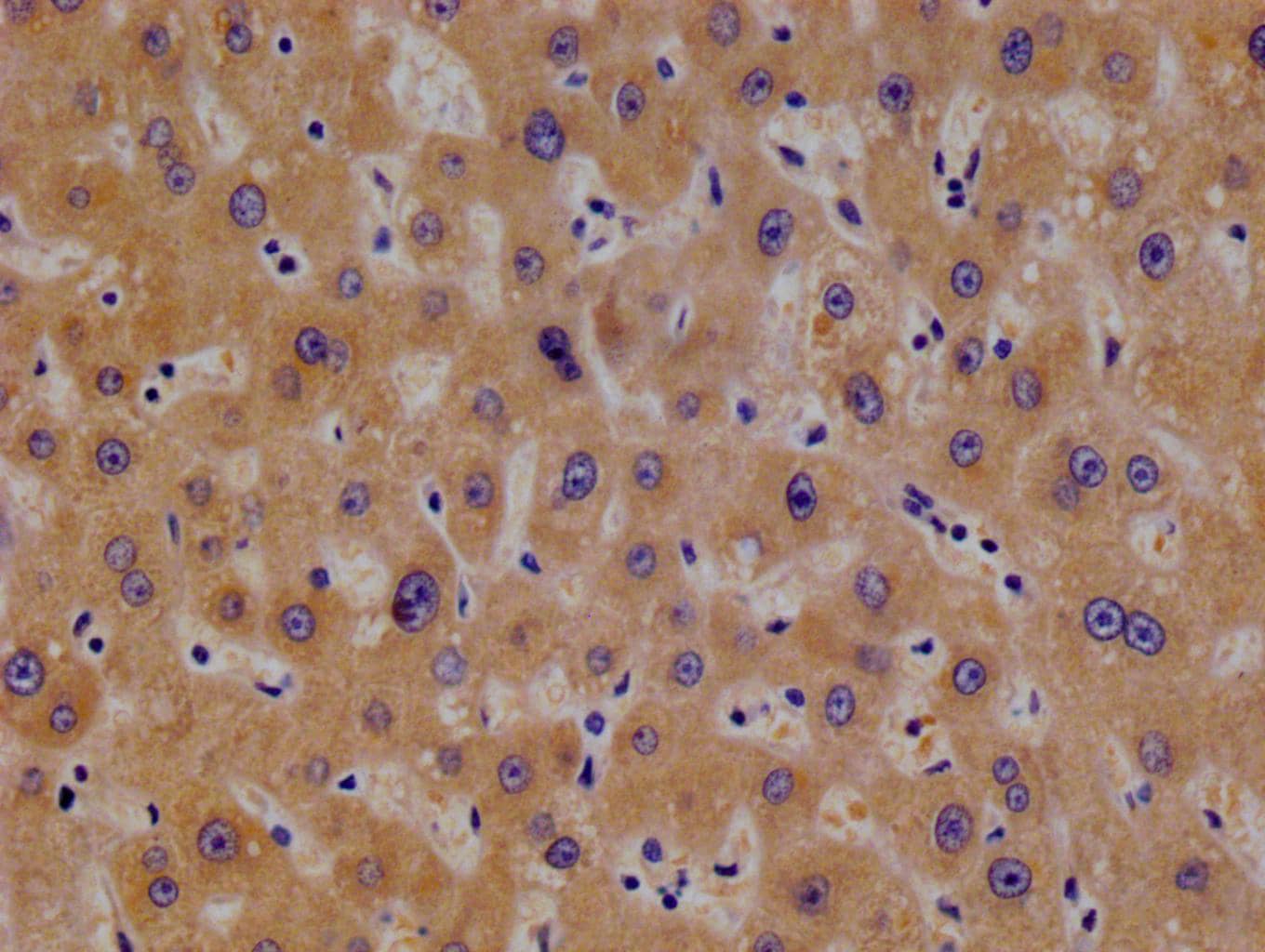 Immunohistochemistry: TBK1 Antibody (14D10) [NBP3-26292] - Image of TBK1 Antibody (14D10) diluted at 1:100 and staining in paraffin-embedded human testis tissue performed. After dewaxing and hydration, antigen retrieval was mediated by high pressure in a citrate buffer (pH 6.0). Section was blocked with 10% normal goat serum 30min at RT. Then primary antibody (1% BSA) was incubated at 4°C overnight. The primary is detected by a Goat anti-rabbit polymer IgG labeled by HRP and visualized using 0.05% DAB.