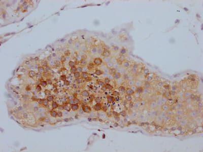 Immunohistochemistry: TACC3 Antibody (10G7) [NBP3-26293] - Image of TACC3 Antibody (10G7) diluted at 1:100 and staining in paraffin-embedded human testis tissue performed. After dewaxing and hydration, antigen retrieval was mediated by high pressure in a citrate buffer (pH 6.0). Section was blocked with 10% normal goat serum 30min at RT. Then primary antibody (1% BSA) was incubated at 4C overnight. The primary is detected by a Goat anti-rabbit IgG polymer labeled by HRP and visualized using 0.05% DAB.