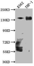 Western Blot: TACC3 Antibody (10G7) [NBP3-26293] - Positive Western Blot detected in: K562 whole cell lysate, THP-1 whole cell lysate. All lanes: TACC3 Antibody at 1: 1000 Secondary: Goat polyclonal to rabbit IgG at 1/50000 dilution. Predicted band size: 91 kDa Observed band size: 140 kDa