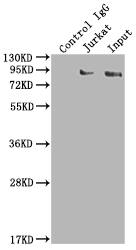 Immunoprecipitation: SUZ12 Antibody (1B10) [NBP3-26295] - Immunoprecipitating SUZ12 in K562 whole cell lysate. Lane 1: Rabbit control IgG instead of NBP3-26295 in K562 whole cell lysate. For western blotting, a HRP-conjugated Protein G antibody was used as the secondary antibody (1/2000). Lane 2: NBP3-26295 (2ug) + K562 whole cell lysate (500ug). Lane 3: K562 whole cell lysate (10ug).