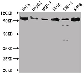 Western Blot: SUZ12 Antibody (1B10) [NBP3-26295] - Positive Western Blot detected in: Hela whole cell lysate, HepG2 whole cell lysate, MCF-7 whole cell lysate, HL60 whole cell lysate, THP-1 whole cell lysate, K562 whole cell lysate. All lanes: SUZ12 Antibody at 1:2000 Secondary: Goat polyclonal to rabbit IgG at 1/50000 dilution. Predicted band size: 84 kDa Observed band size: 90 kDa