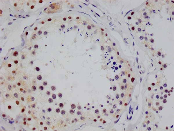 Immunohistochemistry: STAT4 Antibody (26G2) [NBP3-26300] - Image of STAT4 Antibody (26G2) diluted at 1:100 and staining in paraffin-embedded human testis tissue performed. After dewaxing and hydration, antigen retrieval was mediated by high pressure in a citrate buffer (pH 6.0). Section was blocked with 10% normal goat serum 30min at RT. Then primary antibody (1% BSA) was incubated at 4C overnight. The primary is detected by a Goat anti-rabbit polymer IgG labeled by HRP and visualized using 0.05% DAB.