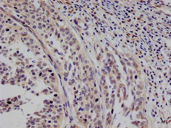 Immunohistochemistry: STAT4 Antibody (26G2) [NBP3-26300] - Image of STAT4 Antibody (26G2) diluted at 1:100 and staining in paraffin-embedded human testis tissue performed. After dewaxing and hydration, antigen retrieval was mediated by high pressure in a citrate buffer (pH 6.0). Section was blocked with 10% normal goat serum 30min at RT. Then primary antibody (1% BSA) was incubated at 4°C overnight. The primary is detected by a Goat anti-rabbit polymer IgG labeled by HRP and visualized using 0.05% DAB.