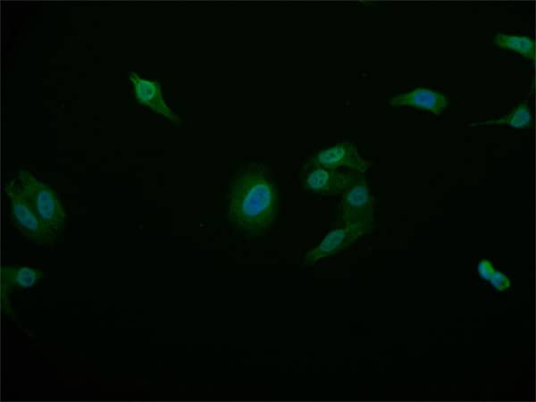 Immunocytochemistry/Immunofluorescence: STAT4 Antibody (26G2) [NBP3-26300] - Staining of HepG2 cell with STAT4 Antibody (26G2) at 1:50, counter-stained with DAPI. The cells were fixed in 4% formaldehyde and blocked in 10% normal Goat Serum. The cells were then incubated with the antibody overnight at 4C. The secondary antibody was Alexa Fluor 515-conjugated Goat Anti-Rabbit IgG (H+L).