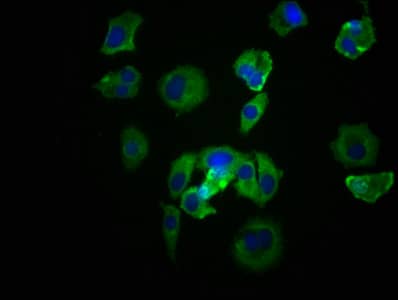 Immunocytochemistry/Immunofluorescence: Src Antibody (21H5) [NBP3-26303] - Staining of MCF-7 cells with Src Antibody (21H5) at 1:39, counter-stained with DAPI. The cells were fixed in 4% formaldehyde, permeabilized using 0.2% Triton X-100 and blocked in 10% normal Goat Serum. The cells were then incubated with the antibody overnight at 4C. The secondary antibody was Alexa Fluor 488-conjugated Goat Anti-Rabbit IgG (H+L).