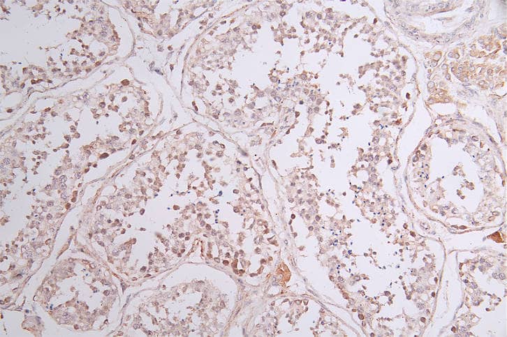 Immunohistochemistry: SOCS-7/Nck/NAP4 Antibody (23E4) [NBP3-26310] - Image of SOCS-7/Nck/NAP4 Antibody (23E4) diluted at 1:50 and staining in paraffin-embedded human testis tissue performed. After dewaxing and hydration, antigen retrieval was mediated by high pressure in a citrate buffer (pH 6.0). Section was blocked with 10% normal goat serum 30min at RT. Then primary antibody (1% BSA) was incubated at 4°C overnight. The primary is detected by a Goat anti-rabbit polymer IgG labeled by HRP and visualized using 0.43% DAB.