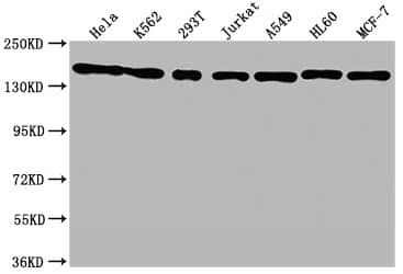 Western Blot: SMC1 Antibody (8C11) [NBP3-26313] - Positive Western Blot detected in: Hela whole cell lysate, K562 whole cell lysate, 293T whole cell lysate, Jurkat whole cell lysate, A549 whole cell lysate, HL60 whole cell lysate, MCF-7 whole cell lysate. All lanes: SMC1 Antibody at 1: 1500 Secondary: Goat polyclonal to rabbit IgG at 1/50000 dilution. Predicted band size: 144 kDa Observed band size: 144 kDa