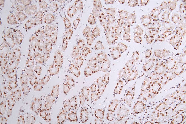 Immunohistochemistry: Brg1 Antibody (22F3) [NBP3-26314] - Image of Brg1 Antibody (22F3) diluted at 1:50 and staining in paraffin-embedded human stomach tissue performed. After dewaxing and hydration, antigen retrieval was mediated by high pressure in a citrate buffer (pH 6.0). Section was blocked with 10% normal goat serum 30min at RT. Then primary antibody (1% BSA) was incubated at 4°C overnight. The primary is detected by a Goat anti-rabbit polymer IgG labeled by HRP and visualized using 0.44% DAB.