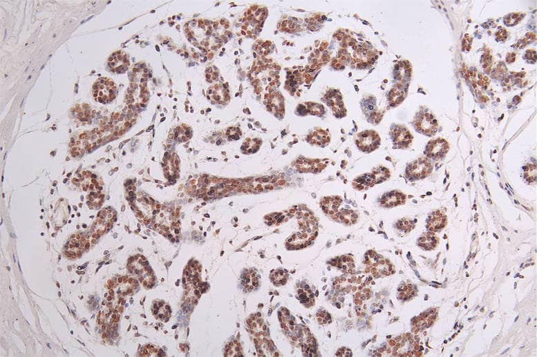 Immunohistochemistry: Brg1 Antibody (22F3) [NBP3-26314] - Image of Brg1 Antibody (22F3) diluted at 1:50 and staining in paraffin-embedded human stomach tissue performed. After dewaxing and hydration, antigen retrieval was mediated by high pressure in a citrate buffer (pH 6.0). Section was blocked with 10% normal goat serum 30min at RT. Then primary antibody (1% BSA) was incubated at 4°C overnight. The primary is detected by a Goat anti-rabbit polymer IgG labeled by HRP and visualized using 0.44% DAB.