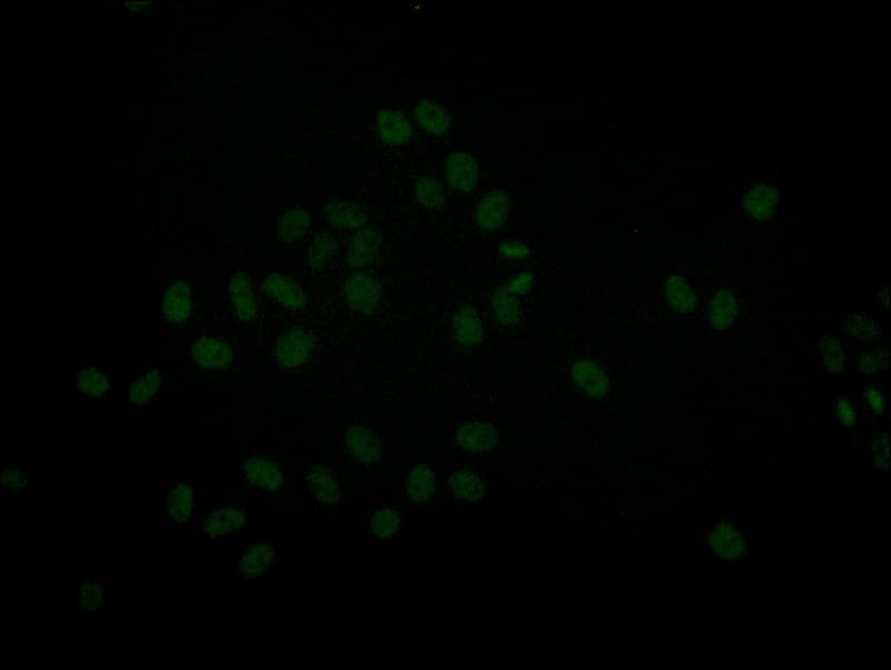 Immunocytochemistry/Immunofluorescence: Brg1 Antibody (22F3) [NBP3-26314] - Staining of Hela with Brg1 Antibody (22F3) at 1:20, counter-stained with DAPI. The cells were fixed in 4% formaldehyde and blocked in 10% normal Goat Serum. The cells were then incubated with the antibody overnight at 4C. The secondary antibody was Alexa Fluor 511-conjugated Goat Anti-Rabbit IgG (H+L).