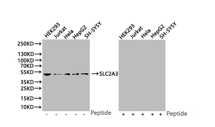 Western Blot: Glut3 Antibody (14B1) [NBP3-26317] -Western Blot Positive WB detected in: 293 whole cell lysate (20µg), JK whole cell lysate (20µg), Hela whole cell lysate (20µg), HepG2 whole cell lysate (20µg), SY5Y whole cell lysate (20µg) All lanes: SLC2A3 antibody at 1:1000 Secondary Goat polyclonal to rabbit IgG at 1/50000 dilution Predicted band size: 54 kDa Observed band size: 54 kDa