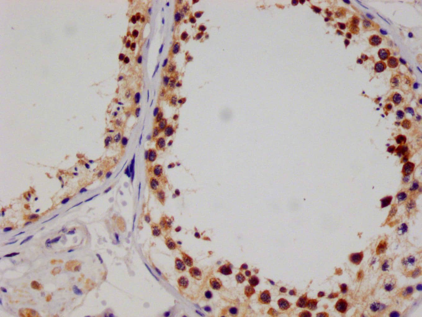 Immunohistochemistry: SENP1 Antibody (25H2) [NBP3-26328] - Image of SENP1 Antibody (25H2) diluted at 1:100 and staining in paraffin-embedded human testis tissue performed. After dewaxing and hydration, antigen retrieval was mediated by high pressure in a citrate buffer (pH 6.0). Section was blocked with 10% normal goat serum 30min at RT. Then primary antibody (1% BSA) was incubated at 4C overnight. The primary is detected by a Goat anti-rabbit polymer IgG labeled by HRP and visualized using 0.05% DAB.