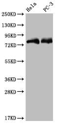 Western Blot: SENP1 Antibody (25H2) [NBP3-26328] - Positive Western Blot detected in: Hela whole cell lysate, PC3 whole cell lysate. All lanes: SENP1 Antibody at 1: 2000 Secondary: Goat polyclonal to rabbit IgG at 1/50000 dilution. Predicted band size: 74 kDa Observed band size: 72-95 kDa