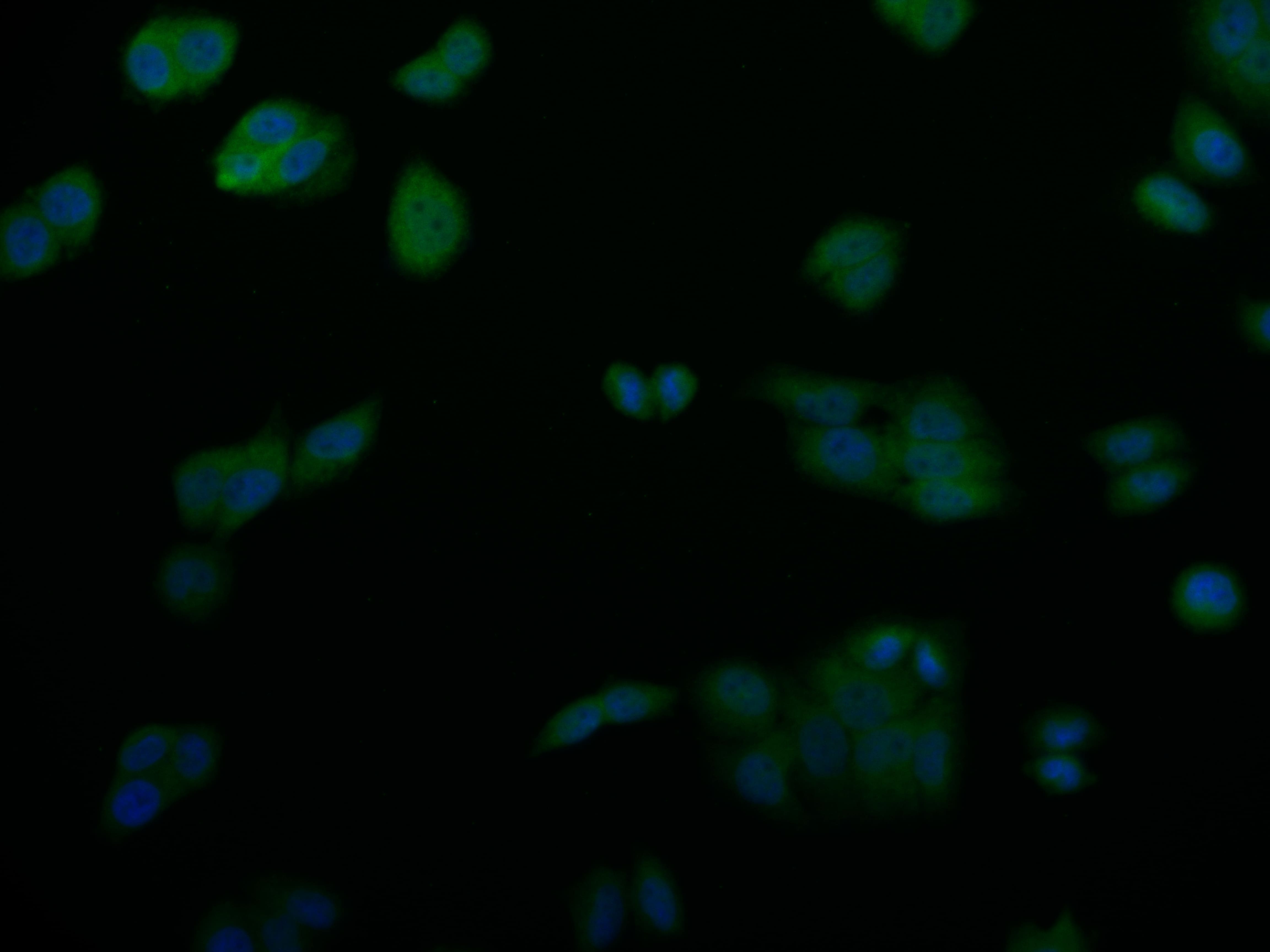 Immunocytochemistry/Immunofluorescence: SENP1 Antibody (25H2) [NBP3-26328] - Staining of PC-3 cell with SENP1 Antibody (25H2) at 1:50, counter-stained with DAPI. The cells were fixed in 4% formaldehyde and blocked in 10% normal Goat Serum. The cells were then incubated with the antibody overnight at 4C. The secondary antibody was Alexa Fluor 527-conjugated Goat Anti-Rabbit IgG (H+L).