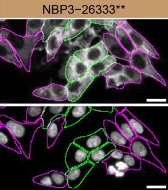 HAP1 parental cell line WT and Syntenin 1 HAP1 KD cells were labelled with a green or a far-red fluorescent dye, respectively. Cells were stained with Syntenin 1 Antibody (19C1) (Catalog # NBP3-26333) followed by incubation with an Alexa-fluor 555 conjugated secondary antibody (upper panel). DAPI-only counterstained cells shown on a lower panel. Acquisition of the blue (nucleus-DAPI), green (identification of WT cells), red (antibody staining) and far-red (identification of KD cells) channels was performed. Representative images of the blue and red (grayscale) channels are shown. WT and KD cells are outlined with green and magenta dashed line, respectively. Primary antibody dilution used: 1/100. Image, protocol and testing courtesy of YCharOS Inc. (ycharos.com).