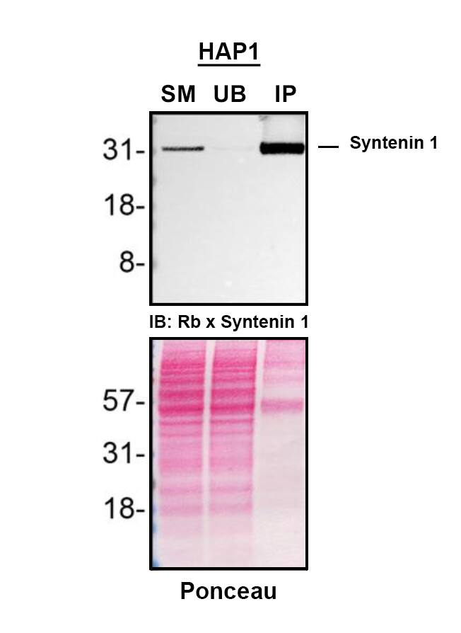 <b>Genetic Strategies Validation. </b>HAP1 cell line lysates were prepared and immunoprecipitation was performed using 2.0 μg of Syntenin 1 Antibody (19C1) (Catalog # NBP3-26333) pre-coupled to Dynabeads Protein A. Immunoprecipitated Syntenin 1 was detected in Western Blot with a rabbit anti-Syntenin 1 antibody used at 1/500. The Ponceau stained transfer of the blot is shown. SM=4% starting material; UB=4% unbound fraction; IP=immunoprecipitate; HC=antibody heavy chain. Image, protocol and testing courtesy of YCharOS Inc. (ycharos.com).