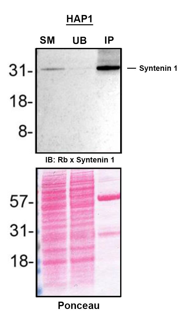 Culture medium from HAP1 cell line culture were prepared and immunoprecipitation was performed using 2.0 µg of Syntenin 1 Antibody (19C1) (Catalog # NBP3-26333) pre-coupled to Dynabeads Protein A. Immunoprecipitated Syntenin 1 was detected in Western Blot with a rabbit anti-Syntenin 1 antibody used at 1/1000. The Ponceau stained transfer of the blot is shown. SM=4% starting material; UB=4% unbound fraction; IP=immunoprecipitate; HC=antibody heavy chain. Image, protocol and testing courtesy of YCharOS Inc. (ycharos.com).