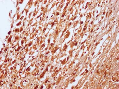 Immunohistochemistry: RNF20 Antibody (2H12) [NBP3-26341] - Image of RNF20 Antibody (2H12) diluted at 1:100 and staining in paraffin-embedded human testis tissue performed. After dewaxing and hydration, antigen retrieval was mediated by high pressure in a citrate buffer (pH 6.0). Section was blocked with 10% normal goat serum 30min at RT. Then primary antibody (1% BSA) was incubated at 4C overnight. The primary is detected by a Goat anti-rabbit IgG polymer labeled by HRP and visualized using 0.05% DAB.