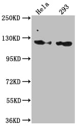 Western Blot: RNF20 Antibody (2H12) [NBP3-26341] - Positive Western Blot detected in: Hela whole cell lysate, 293 whole cell lysate. All lanes: RNF20 Antibody at 1: 1000 Secondary: Goat polyclonal to rabbit IgG at 1/50000 dilution. Predicted band size: 114 kDa Observed band size: 114 kDa