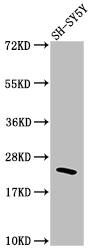 Western Blot: RhoA Antibody (1C11) [NBP3-26343] - Positive Western Blot detected in: SH-SY5Y whole cell lysate. All lanes: RhoA Antibody at 1: 1500 Secondary: Goat polyclonal to rabbit IgG at 1/50000 dilution. Predicted band size: 22 kDa Observed band size: 22 kDa