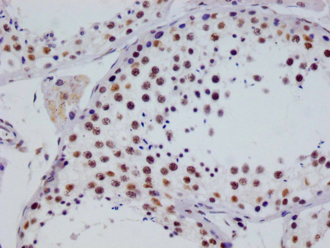 Immunohistochemistry: RGS6 Antibody (12H5) [NBP3-26346] - Image of RGS6 Antibody (12H5) diluted at 1:100 and staining in paraffin-embedded human testis tissue performed. After dewaxing and hydration, antigen retrieval was mediated by high pressure in a citrate buffer (pH 6.0). Section was blocked with 10% normal goat serum 30min at RT. Then primary antibody (1% BSA) was incubated at 4°C overnight. The primary is detected by a Goat anti-rabbit polymer IgG labeled by HRP and visualized using 0.05% DAB.