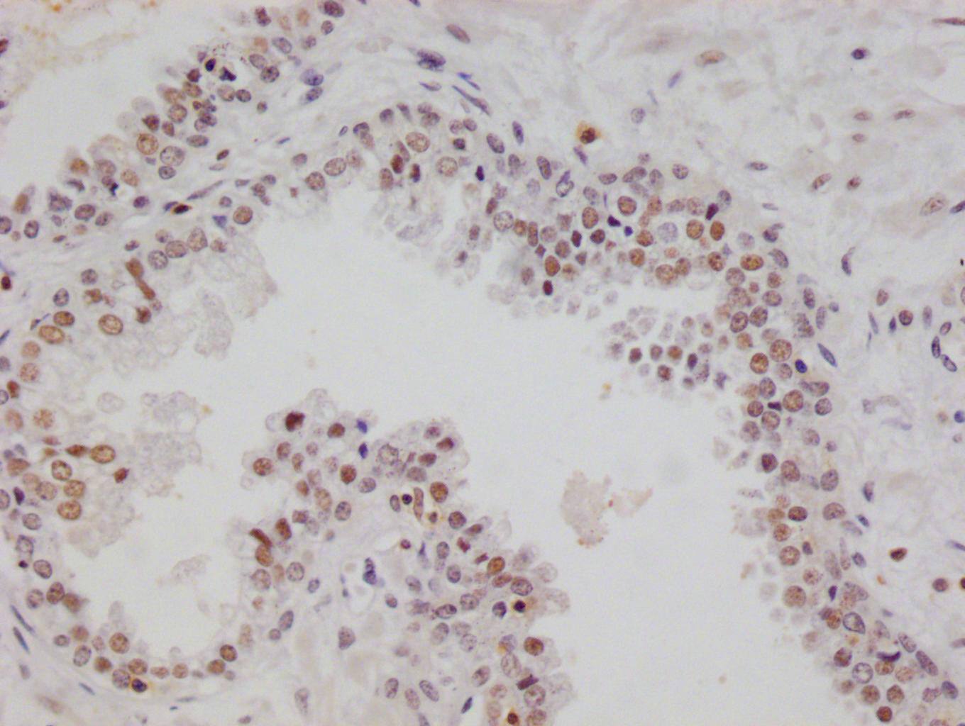 Immunohistochemistry: RGS6 Antibody (12H5) [NBP3-26346] - Image of RGS6 Antibody (12H5) diluted at 1:100 and staining in paraffin-embedded human testis tissue performed. After dewaxing and hydration, antigen retrieval was mediated by high pressure in a citrate buffer (pH 6.0). Section was blocked with 10% normal goat serum 30min at RT. Then primary antibody (1% BSA) was incubated at 4°C overnight. The primary is detected by a Goat anti-rabbit polymer IgG labeled by HRP and visualized using 0.05% DAB.