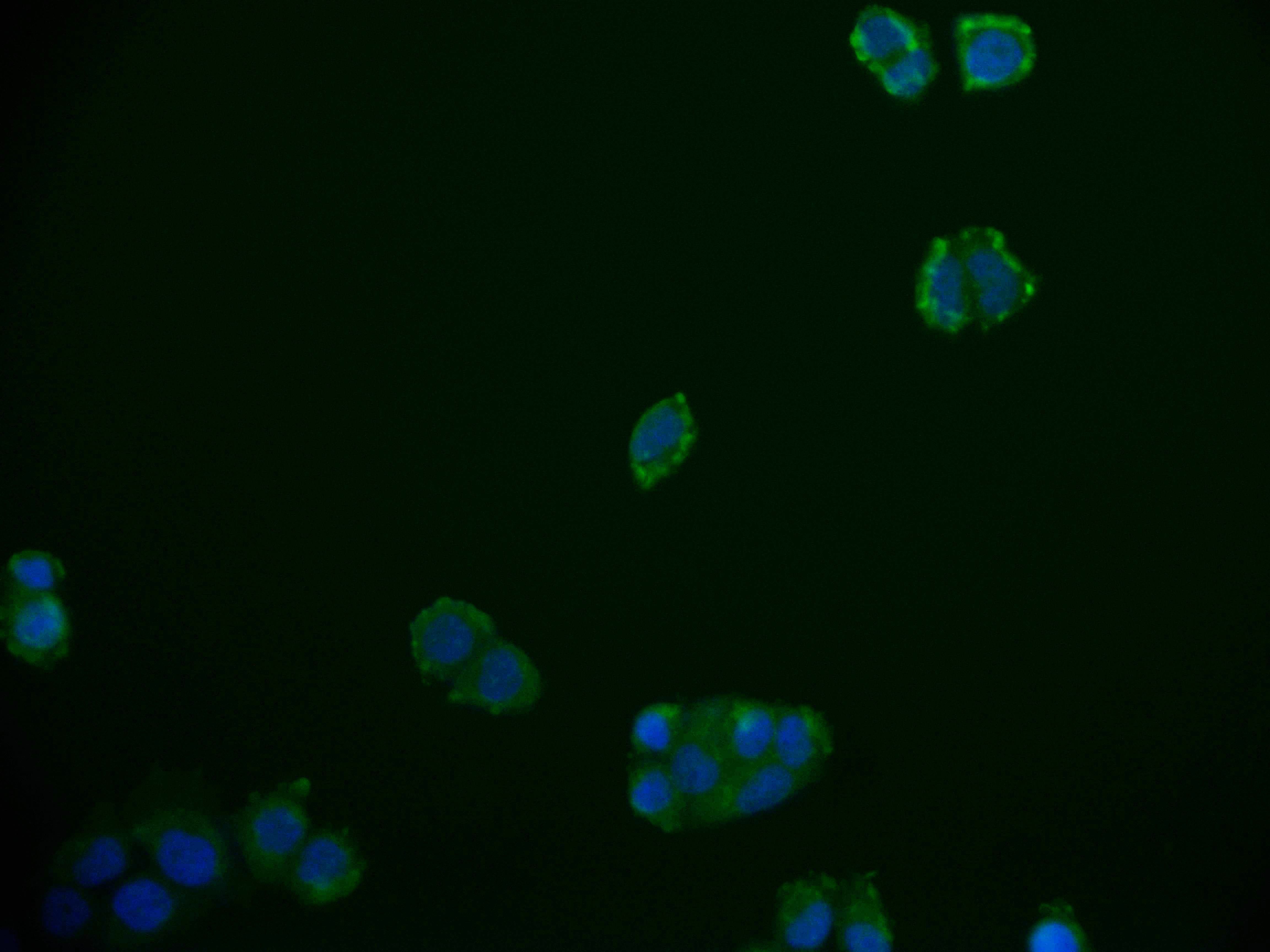 Immunocytochemistry/Immunofluorescence: RGS6 Antibody (12H5) [NBP3-26346] - Staining of PC-3 cell with RGS6 Antibody (12H5) at 1:50, counter-stained with DAPI. The cells were fixed in 4% formaldehyde and blocked in 10% normal Goat Serum. The cells were then incubated with the antibody overnight at 4C. The secondary antibody was Alexa Fluor 592-conjugated Goat Anti-Rabbit IgG (H+L).