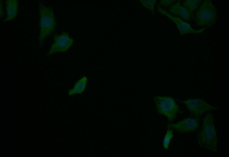 Immunocytochemistry/Immunofluorescence: RelB Antibody (9E4) [NBP3-26348] - Staining of Hela with RelB Antibody (9E4) at 1:25, counter-stained with DAPI. The cells were fixed in 4% formaldehyde and blocked in 10% normal Goat Serum. The cells were then incubated with the antibody overnight at 4C. The secondary antibody was Alexa Fluor 507-conjugated Goat Anti-Rabbit IgG (H+L).