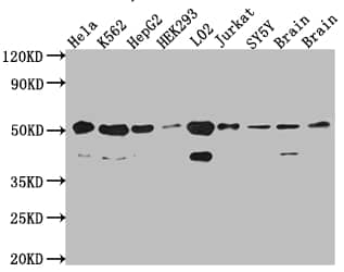 Western Blot: RBBP4/RbAp48 Antibody (3E9) [NBP3-26350] - Positive Western Blot detected in: Hela whole cell lysate, K562 whole cell lysate, HepG2 whole cell lysate, HEK293 whole cell lysate, L02 whole cell lysate, Jurkat whole cell lysate, SH-SY5Y whole cell lysate, Mouse Brain whole cell lysate, Rat Brain cell lysate. All lanes: RBBP4/RbAp48 Antibody at 1: 1000 Secondary: Goat polyclonal to rabbit IgG at 1/50000 dilution. Predicted band size: 48, 48, 47, 44 kDa Observed band size: 53, 40 kDa