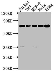 Western Blot: SHP-2/PTPN11 Antibody (7A1) [NBP3-26358] - Positive Western Blot detected in: Jurkat whole cell lysate, 293 whole cell lysate, MCF-7 whole cell lysate, Hela whole cell lysate, K562 whole cell lysate. All lanes: SHP-2/PTPN11 Antibody at 1: 2000 Secondary: Goat polyclonal to rabbit IgG at 1/50000 dilution. Predicted band size: 69, 53 kDa Observed band size: 69 kDa