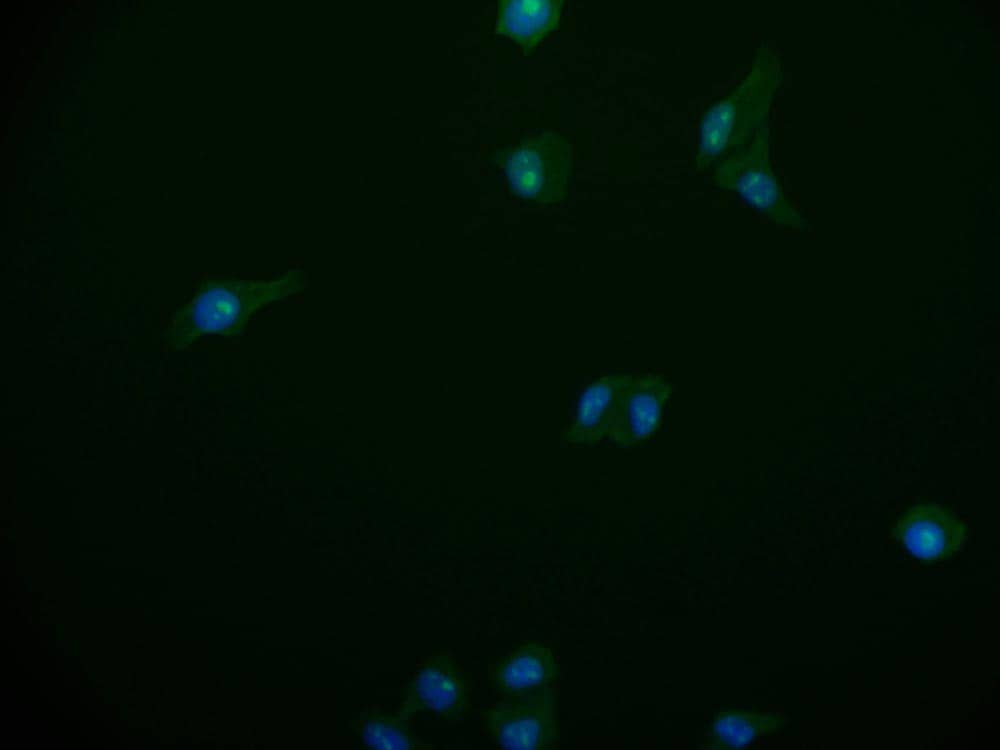 Immunocytochemistry/Immunofluorescence: PA28 Activator alpha Subunit/PSME1 Antibody (29D5) [NBP3-26364] - Staining of HepG2 cell with PA28 Activator alpha Subunit/PSME1 Antibody (29D5) at 1:50, counter-stained with DAPI. The cells were fixed in 4% formaldehyde and blocked in 10% normal Goat Serum. The cells were then incubated with the antibody overnight at 4C. The secondary antibody was Alexa Fluor 518-conjugated Goat Anti-Rabbit IgG (H+L).