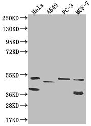 Western Blot: TAPP1/PLEKHA1 Antibody (16C9) [NBP3-26375] - Positive Western Blot detected in: Hela whole cell lysate, A549 whole cell lysate, PC-3 whole cell lysate, MCF-7 whole cell lysate. All lanes: TAPP1/PLEKHA1 Antibody at 1: 1000 Secondary: Goat polyclonal to rabbit IgG at 1/50000 dilution. Predicted band size: 46, 39 kDa Observed band size: 36-55 kDa