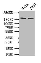 Western Blot: PKN2 Antibody (11H3) [NBP3-26378] - Positive Western Blot detected in: Hela whole cell lysate, 293T whole cell lysate. All lanes: PKN2 Antibody at 1: 1000 Secondary: Goat polyclonal to rabbit IgG at 1/50000 dilution. Predicted band size: 140 kDa Observed band size: 140 kDa