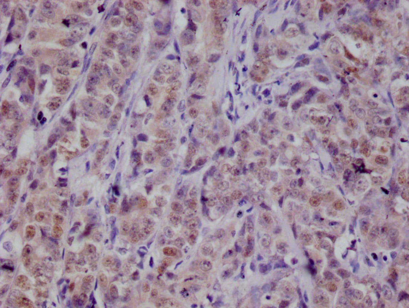 Immunohistochemistry PKN2 Antibody (20A8)