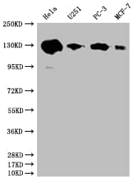 Western Blot: PKN2 Antibody (20A8) [NBP3-26379] - Positive Western Blot detected in: Hela whole cell lysate, U251 whole cell lysate, PC3 whole cell lysate, MCF-7 whole cell lysate. All lanes: PKN2 Antibody at 1: 2000 Secondary: Goat polyclonal to rabbit IgG at 1/50000 dilution. Predicted band size: 113, 117, 112 kDa Observed band size: 130 kDa