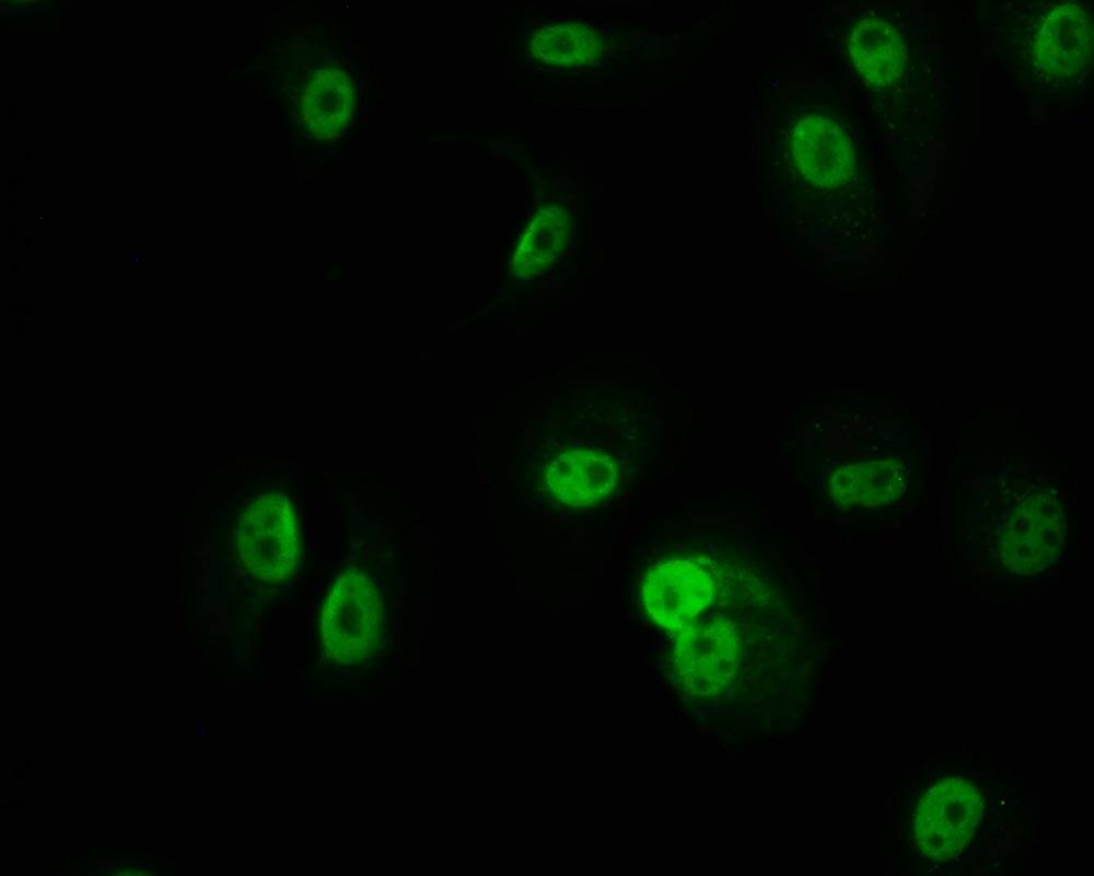 Immunocytochemistry/Immunofluorescence: PKN2 Antibody (20A8) [NBP3-26379] - Staining of MCF-7 cell with PKN2 Antibody (20A8) at 1:50, counter-stained with DAPI. The cells were fixed in 4% formaldehyde and blocked in 10% normal Goat Serum. The cells were then incubated with the antibody overnight at 4C. The secondary antibody was Alexa Fluor 509-conjugated Goat Anti-Rabbit IgG (H+L).