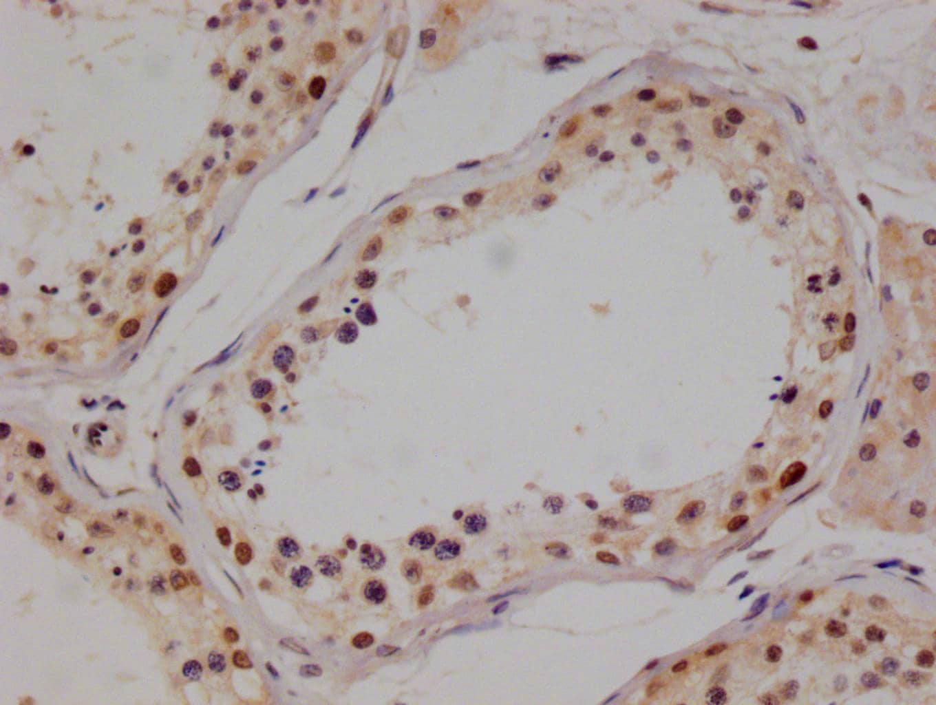 Immunohistochemistry: PIN4 Antibody (14A7) [NBP3-26381] - Image of PIN4 Antibody (14A7) diluted at 1:100 and staining in paraffin-embedded human testis tissue performed. After dewaxing and hydration, antigen retrieval was mediated by high pressure in a citrate buffer (pH 6.0). Section was blocked with 10% normal goat serum 30min at RT. Then primary antibody (1% BSA) was incubated at 4°C overnight. The primary is detected by a Goat anti-rabbit polymer IgG labeled by HRP and visualized using 0.05% DAB.