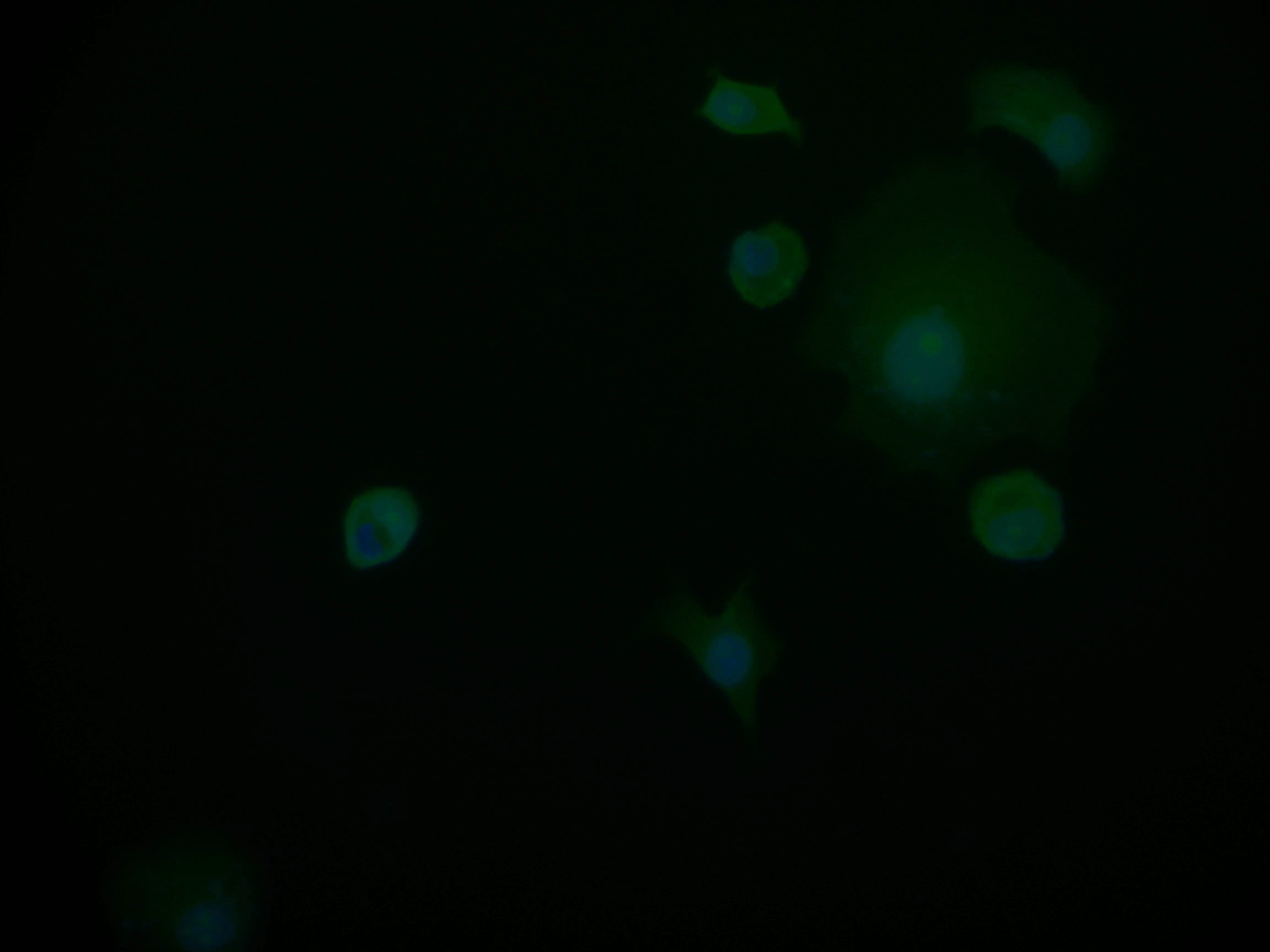 Immunocytochemistry/Immunofluorescence: PIN4 Antibody (14A7) [NBP3-26381] - Staining of MCF-7 cell with PIN4 Antibody (14A7) at 1:50, counter-stained with DAPI. The cells were fixed in 4% formaldehyde and blocked in 10% normal Goat Serum. The cells were then incubated with the antibody overnight at 4C. The secondary antibody was Alexa Fluor 598-conjugated Goat Anti-Rabbit IgG (H+L).