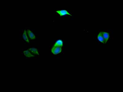 Immunocytochemistry/Immunofluorescence: PIK3CA Antibody (10E5) [NBP3-26384] - Staining of Hela Cells with PIK3CA Antibody (10E5) at 1:50, counter-stained with DAPI. The cells were fixed in 4% formaldehyde, permeated by 0.2% Triton X-100, and blocked in 10% normal Goat Serum. The cells were then incubated with the antibody overnight at 4C. Nuclear DNA was labeled in blue with DAPI. The secondary antibody was FITC-conjugated Goat Anti-Rabbit IgG (H+L).