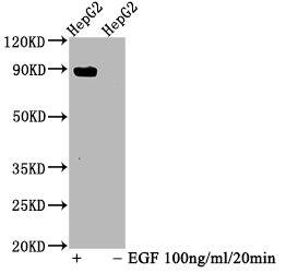 Western Blot: STAT5A [p Tyr694] Antibody (3F1) [NBP3-26387] - Positive Western Blot detected in HepG2 whole cell lysate (treated with EGF or not). All lanes: STAT5A [p Tyr694] Antibody at 1.025ug/ml. Secondary: Goat polyclonal to rabbit IgG at 1/50000 dilution. Predicted band size: 90 KDa Observed band size: 90 KDa