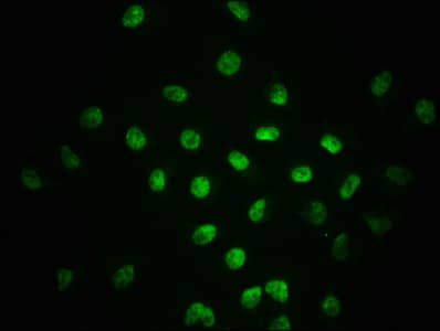 Immunocytochemistry/Immunofluorescence: Smad2 [p Ser255] Antibody (2A12) [NBP3-26391] - Staining of A549 cells with Smad2 [p Ser255] Antibody (2A12) at 1:100, counter-stained with DAPI. The cells were fixed in 4% formaldehyde, permeabilized using 0.2% Triton X-100 and blocked in 10% normal Goat Serum. The cells were then incubated with the antibody overnight at 4C. The secondary antibody was Alexa Fluor 488-conjugated Goat Anti-Rabbit IgG (H+L).