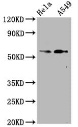 Western Blot: Smad2 [p Ser250] Antibody (4D12) [NBP3-26392] - Positive Western Blot detected in Hela whole cell lysate, A549 whole cell lysate. All lanes: Smad2 [p Ser250] Antibody at 1.07ug/ml. Secondary: Goat polyclonal to rabbit IgG at 1/50000 dilution. Predicted band size: 58 KDa Observed band size: 58 KDa