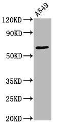 Western Blot: PKC zeta [p Thr560] Antibody (1B10) [NBP3-26399] - Positive Western Blot detected in A549 whole cell lysate. All lanes: PKC zeta [p Thr560] Antibody at 1.55ug/ml. Secondary: Goat polyclonal to rabbit IgG at 1/50000 dilution. Predicted band size: 68 KDa Observed band size: 68 KDa