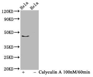 Western Blot: IRF3 [p Ser386] Antibody (4H10) [NBP3-26416] - Positive Western Blot detected in Hela whole cell lysate (treated with Calyculin A or not). All lanes: IRF3 [p Ser386] Antibody at 1.03ug/ml. Secondary: Goat polyclonal to rabbit IgG at 1/50000 dilution. Predicted band size: 47 KDa Observed band size: 47 KDa