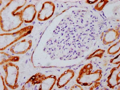 Immunohistochemistry: GSK-3 beta [p Ser9] Antibody (3A6) [NBP3-26422] - Image of GSK-3 beta [p Ser9] Antibody (3A6) diluted at 1:100 and staining in paraffin-embedded human kidney tissue performed. After dewaxing and hydration, antigen retrieval was mediated by high pressure in a citrate buffer (pH 6.0). Section was blocked with 10% normal goat serum 30min at RT. Then primary antibody (1% BSA) was incubated at 4C overnight. The primary is detected by a biotinylated secondary antibody and visualized using an HRP conjugated SP system.