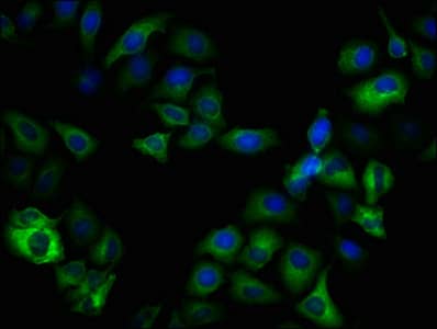 Immunocytochemistry/Immunofluorescence: GSK-3 beta [p Ser9] Antibody (3A6) [NBP3-26422] - Staining of Hela cells(treated with 50mM Calyculin A for 30min) with GSK-3 beta [p Ser9] Antibody (3A6) at 1:100, counter-stained with DAPI. The cells were fixed in 4% formaldehyde, permeabilized using 0.2% Triton X-100 and blocked in 10% normal Goat Serum. The cells were then incubated with the antibody overnight at 4C. The secondary antibody was Alexa Fluor 488-conjugated Goat Anti-Rabbit IgG (H+L).